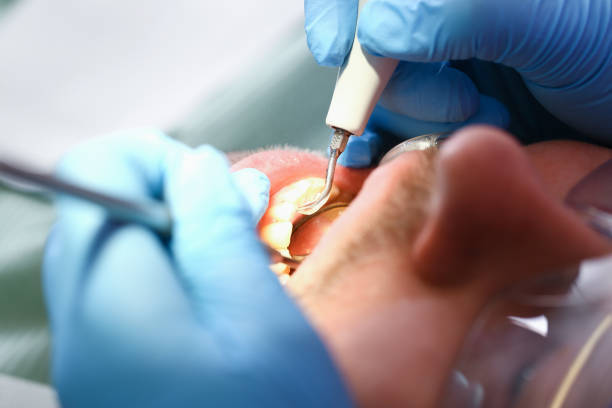 Best Emergency Treatment for Oral Infections in Grayson, GA